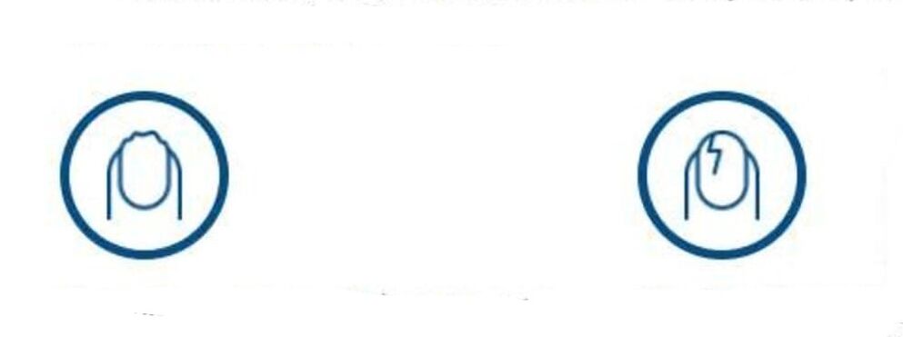 Deformazione delle unghie dovuta a infezione fungina